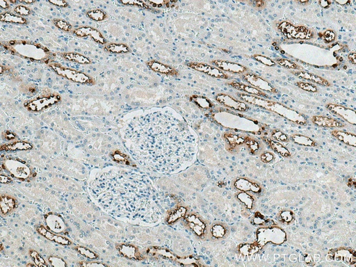 [21570-1-AP-20UL] ATP6V0A4 Polyclonal antibody