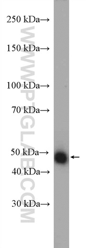 [21572-1-AP-20UL] JMJD4 Polyclonal antibody