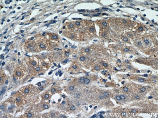 [21573-1-AP-150UL] MOGAT1 Polyclonal antibody