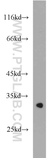 [21575-1-AP-150UL] LRRC10 Polyclonal antibody