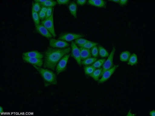 [21577-1-AP-150UL] VMO1 Polyclonal antibody