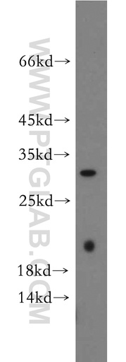 [21578-1-AP-150UL] INMT Polyclonal antibody