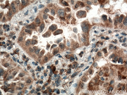 [21579-1-AP-20UL] CYP2F1 Polyclonal antibody