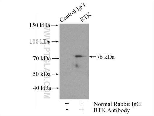 [21581-1-AP-20UL] BTK Polyclonal antibody