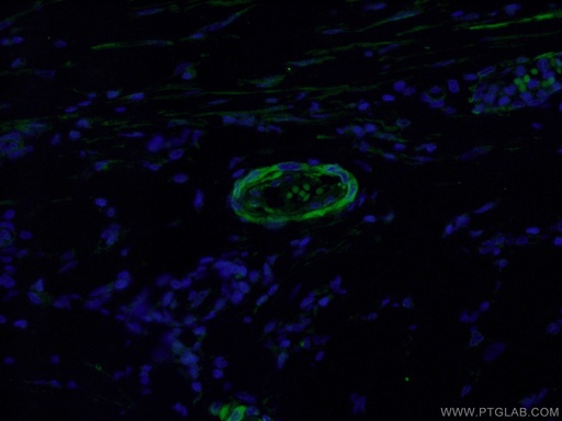 [21584-1-AP-150UL] DLL4 Polyclonal antibody