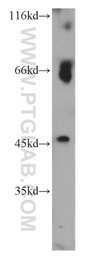 [21586-1-AP-150UL] CHRNA7/CHRFAM7A Polyclonal antibody