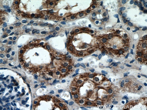 [21589-1-AP-150UL] C7orf10 Polyclonal antibody