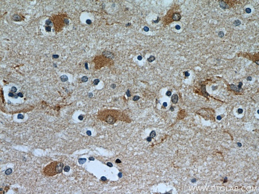 [21590-1-AP-20UL] OGFOD2 Polyclonal antibody