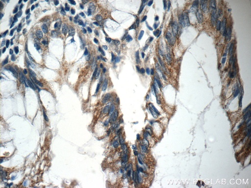 [21593-1-AP-20UL] NGX6 Polyclonal antibody