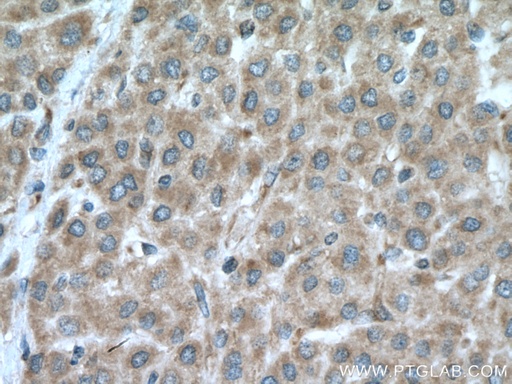 [21599-1-AP-20UL] DNA2 Polyclonal antibody