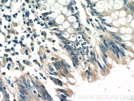 [21600-1-AP-20UL] TTC7A Polyclonal antibody