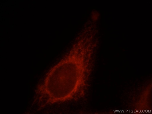 [21604-1-AP-150UL] MRPL28 Polyclonal antibody