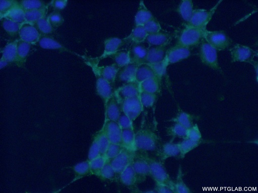 [21608-1-AP-150UL] NRCAM Polyclonal antibody