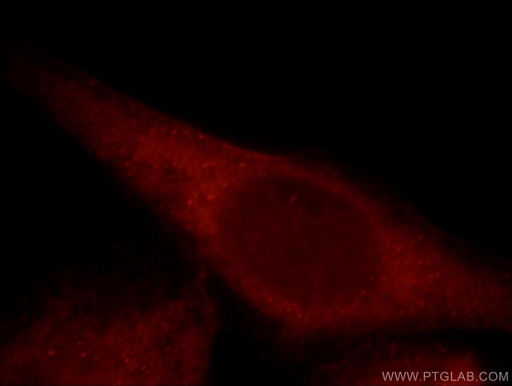 [21610-1-AP-20UL] MAP3K4 Polyclonal antibody