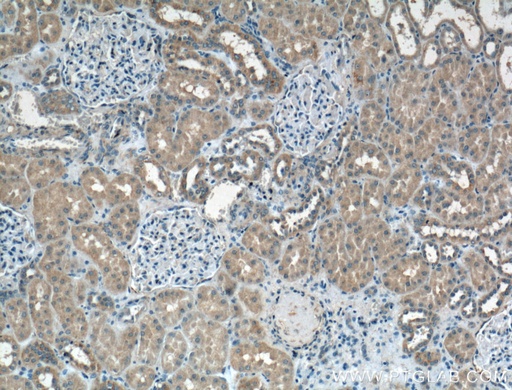 [21612-1-AP-150UL] PFTK1 Polyclonal antibody