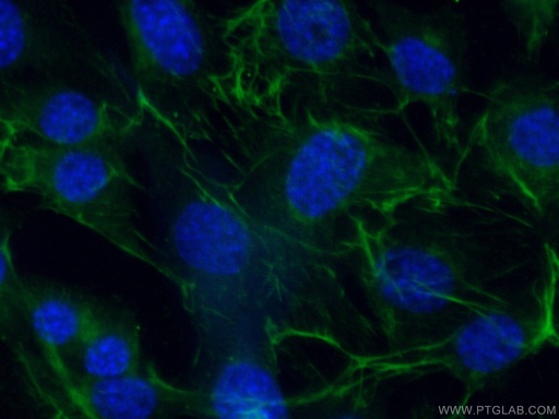 [21613-1-AP-20UL] Adiponectin Polyclonal antibody