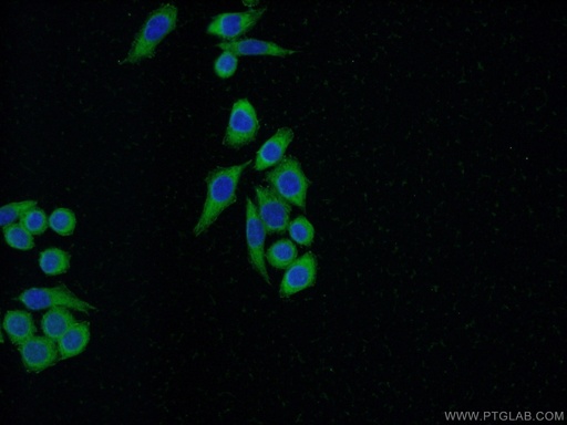 [21619-1-AP-20UL] FHL2 Polyclonal antibody
