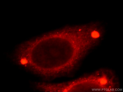 [21620-1-AP-20UL] TMED9 Polyclonal antibody