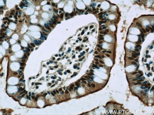 [21622-1-AP-150UL] GPBP1 Polyclonal antibody