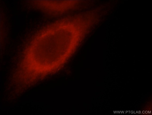 [21624-1-AP-20UL] STRN Polyclonal antibody