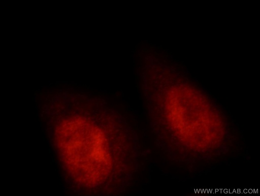 [21625-1-AP-20UL] RNF20 Polyclonal antibody
