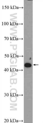[21627-1-AP-20UL] ZDHHC15 Polyclonal antibody