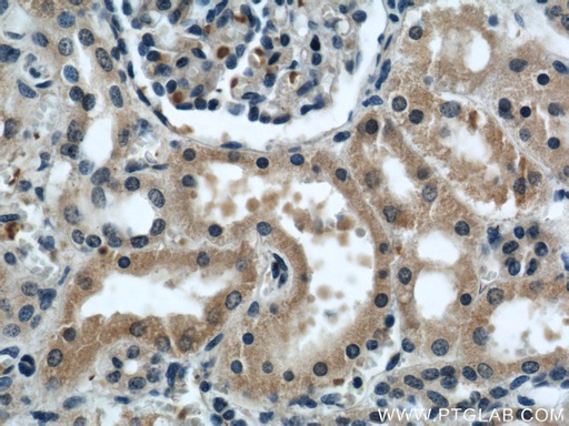 [21632-1-AP-20UL] KIF5B Polyclonal antibody