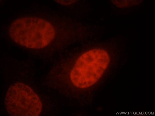 [21634-1-AP-150UL] SMARCA4/BRG1 Polyclonal antibody