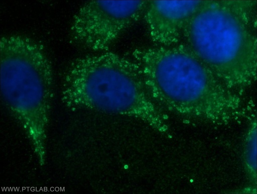 [21636-1-AP-150UL] RPLP1 Polyclonal antibody
