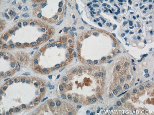 [21641-1-AP-20UL] AKT3 Polyclonal antibody