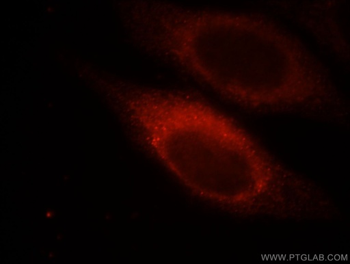 [21642-1-AP-150UL] MYLK Polyclonal antibody