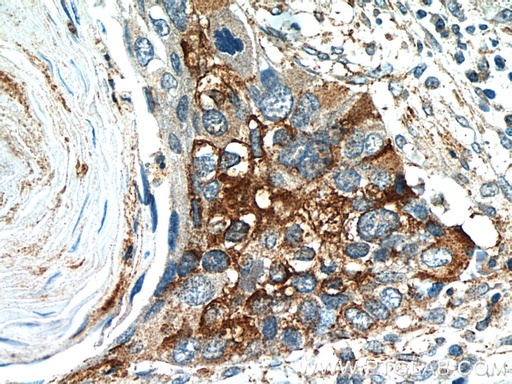 [21644-1-AP-150UL] Cyclin B2 Polyclonal antibody