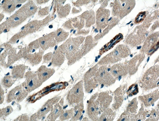 [21646-1-AP-150UL] PRKG1 Polyclonal antibody
