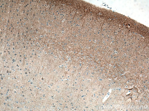 [21647-1-AP-150UL] GIRK2 Polyclonal antibody