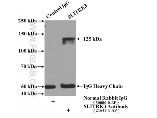 [21649-1-AP-150UL] SLITRK3 Polyclonal antibody