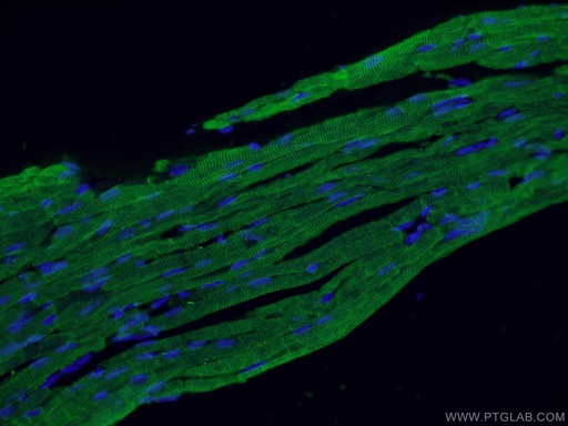 [21652-1-AP-150UL] Cardiac Troponin I Polyclonal antibody
