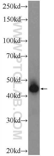 [21653-1-AP-150UL] HOXB1 Polyclonal antibody