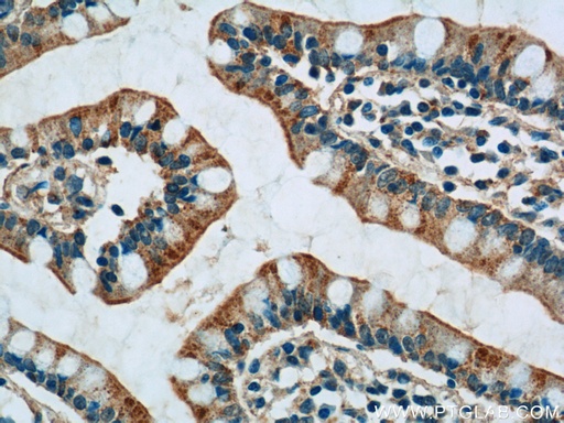 [21654-1-AP-20UL] PPYR1 Polyclonal antibody