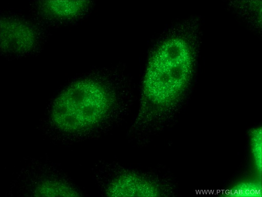 [21655-1-AP-150UL] CDX1 Polyclonal antibody