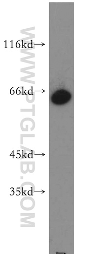 [21656-1-AP-20UL] ZNF192 Polyclonal antibody