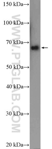 [21659-1-AP-150UL] KCNA5 Polyclonal antibody