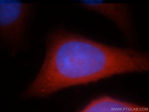 [21663-1-AP-150UL] RAB3GAP1 Polyclonal antibody