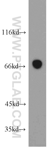 [21668-1-AP-20UL] SESN1 Polyclonal antibody