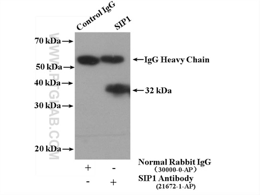[21672-1-AP-150UL] SIP1 Polyclonal antibody