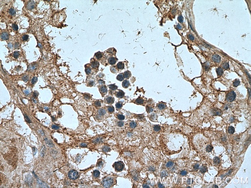 [21679-1-AP-20UL] NANOS3 Polyclonal antibody