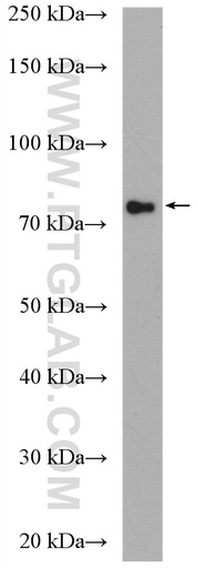 [21681-1-AP-150UL] ZNF132 Polyclonal antibody
