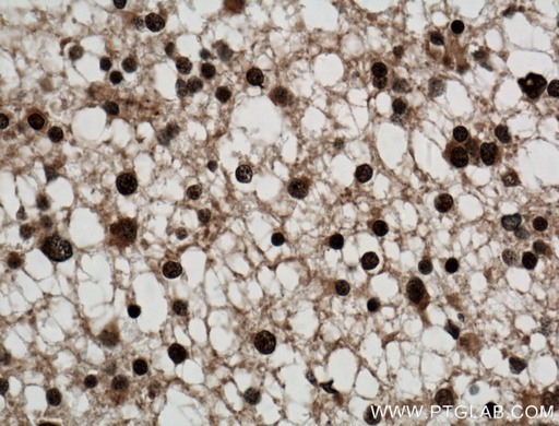 [21695-1-AP-150UL] SMC1A Polyclonal antibody