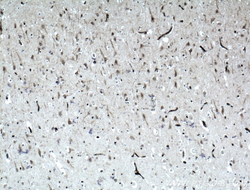 [21696-1-AP-20UL] Teneurin 1 Polyclonal antibody