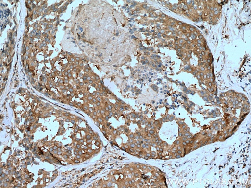 [21698-1-AP-20UL] NEDD4 Polyclonal antibody