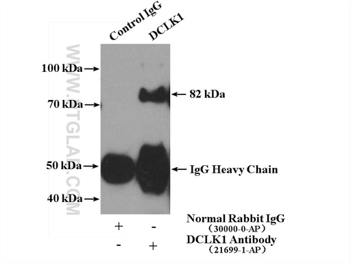 [21699-1-AP-150UL] DCLK1 Polyclonal antibody